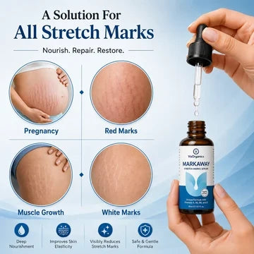 Markaway Stretch Mark Serum