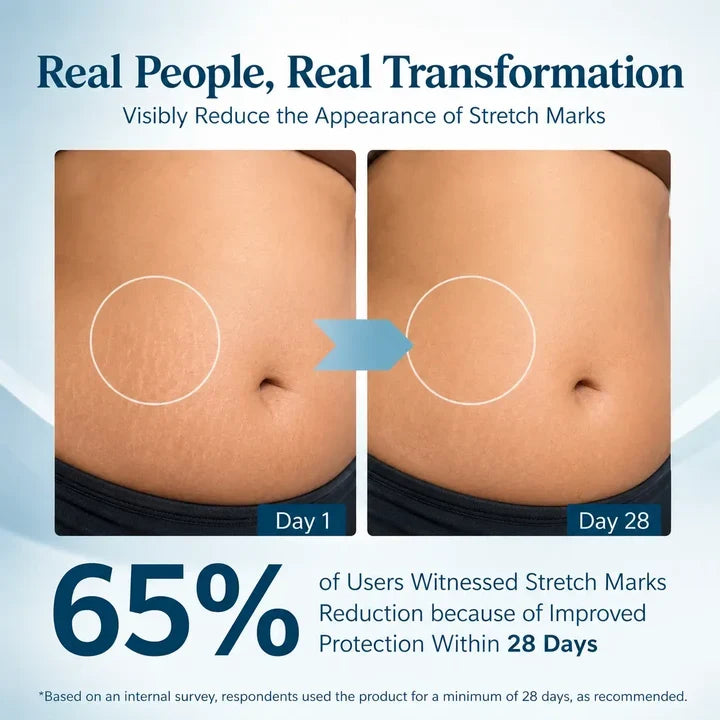Markaway Stretch Mark Serum